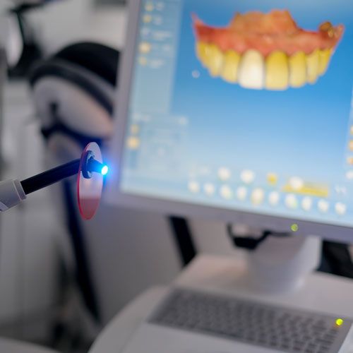 Dentist using intraoral camera to examine teeth with digital display showing dental scan on monitor.