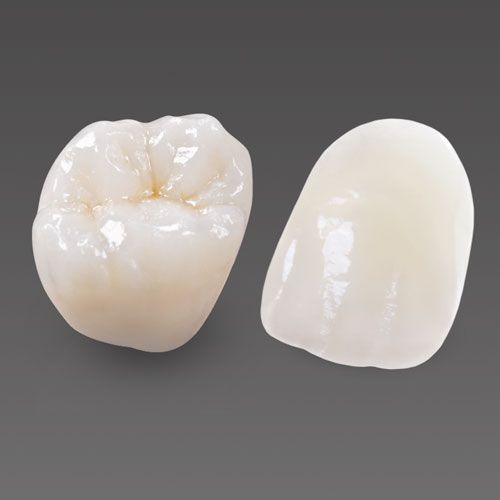 Dental crown restoration showing occlusal and buccal views of ceramic tooth crown on gray background.