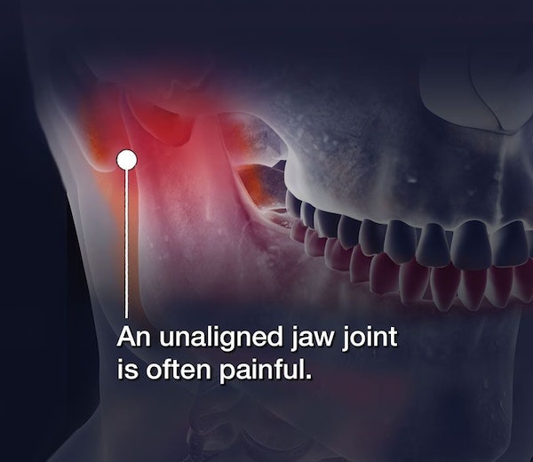 Anatomical diagram showing unaligned jaw joint with red inflammation highlighting pain in dental context.