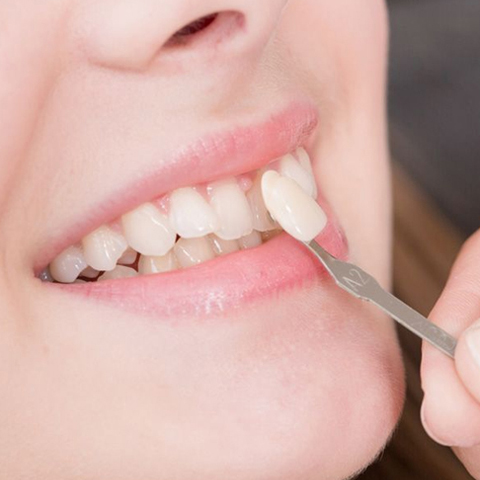 Close-up of person's smile showing white teeth during dental examination with mirror tool.